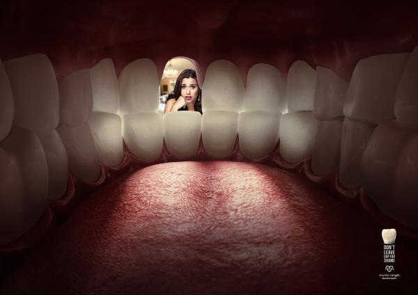 IMPLANTES DENTÁRIOS