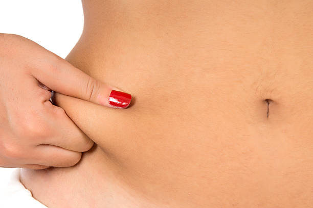 Quais os riscos de uma cirurgia de abdominoplastia