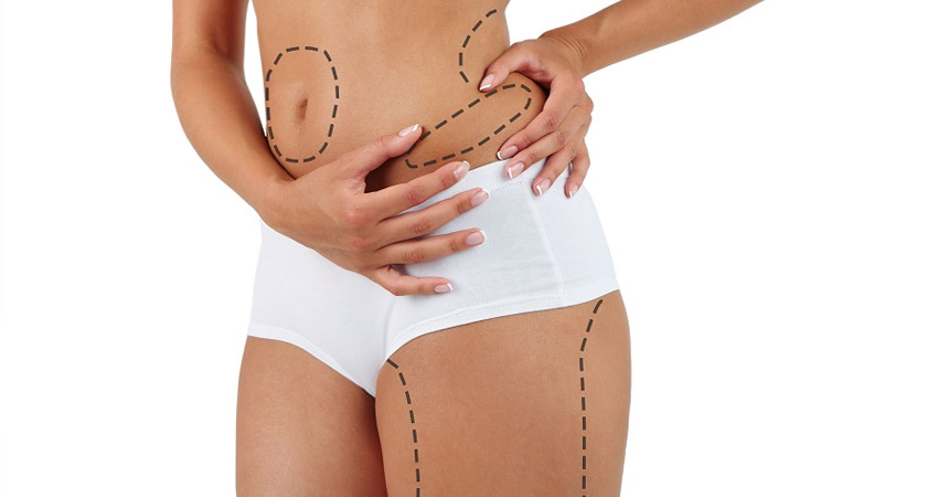 Os riscos da cirurgia plástica para os famosos: a pressão constante da exposição pública