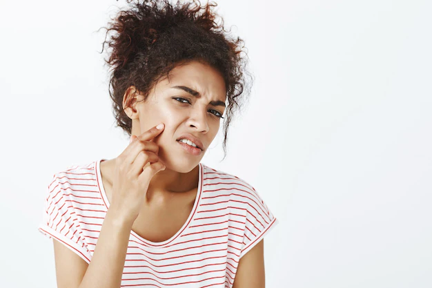 “Quais são as opções de tratamento mais eficazes para acne?”