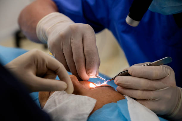 Blefaroplastia: Desvendando o procedimento para um olhar renovado