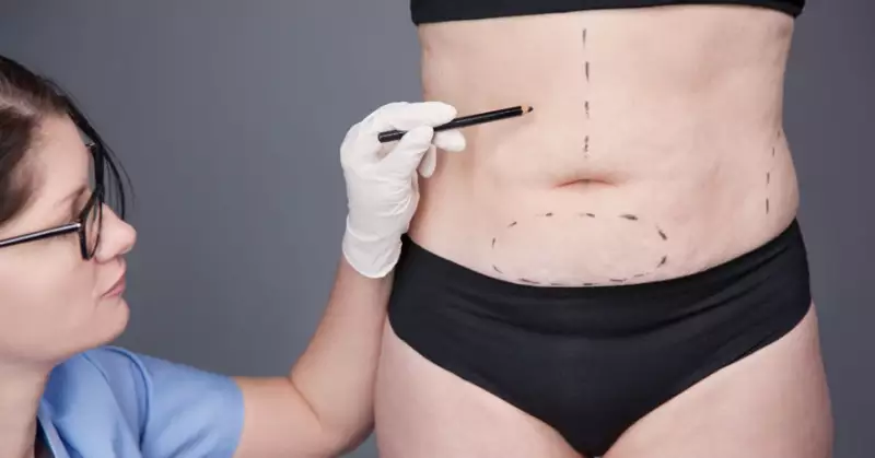 Como a cirurgia  de redução de gordura pode ajudar na autoestima?