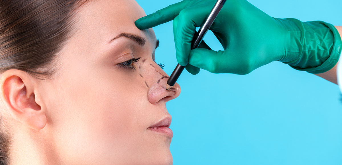 Rinoplastia: Tudo o que você precisa saber antes, durante e depois da cirurgia