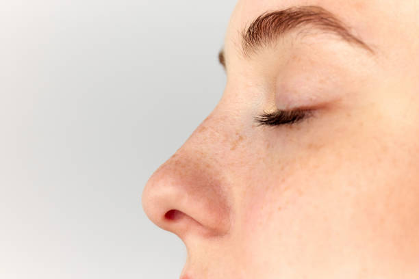 Rinoplastia: Riscos e Benefícios para uma Transformação Nasal com Segurança