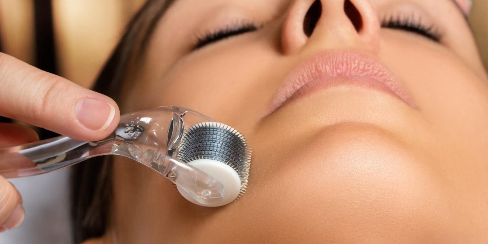 Microagulhamento: A Nova Aposta para uma Pele Mais Jovem e Radiante